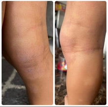 Load image into Gallery viewer, Eczema Body Butter