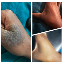 Load image into Gallery viewer, Eczema Body Butter
