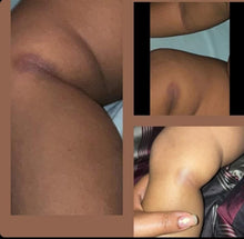 Load image into Gallery viewer, Eczema Body Butter
